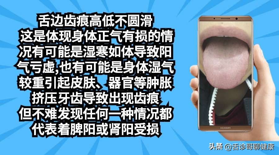 抖音舌诊哥,舌诊歌舌象分析和感悟