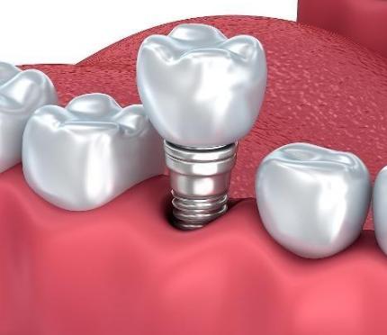 五岁小孩牙齿蛀了需要补吗,门牙边上的牙齿蛀了能补吗