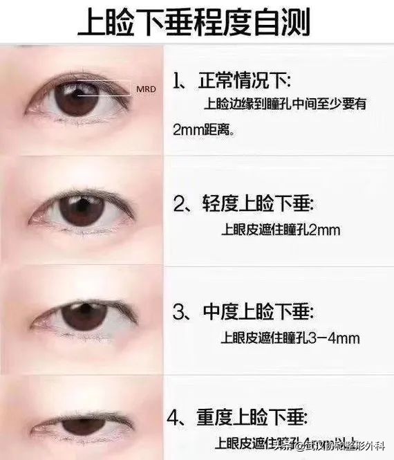 上海九院整形和协和整形,北京协和整形医院美容整形价格