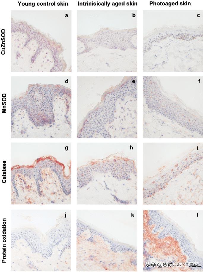 如何防止光老化氧化,预防光老化的最佳方法