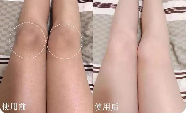 洗澡搓出来的泥每天都可以洗,洗澡搓出来的泥增多了