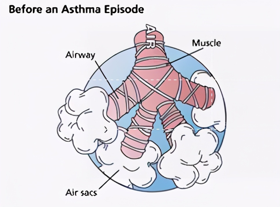 增强肺功能的呼吸体操,医生正确呼吸操