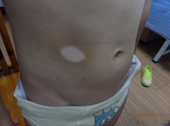 6岁男孩上吐下泻吃什么药,6岁男孩上吐下泻什么原因