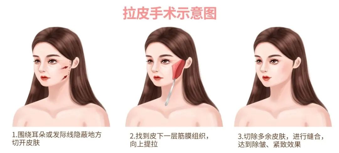 如何有效提升面部年轻化,怎么样保持脸部年轻的状态