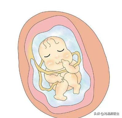 免疫不良妊娠是什么意思,免疫导致不良妊娠怎么干预