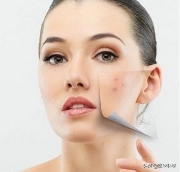 为什么脸上老长痘痘,生完孩子脸上长痘痘
