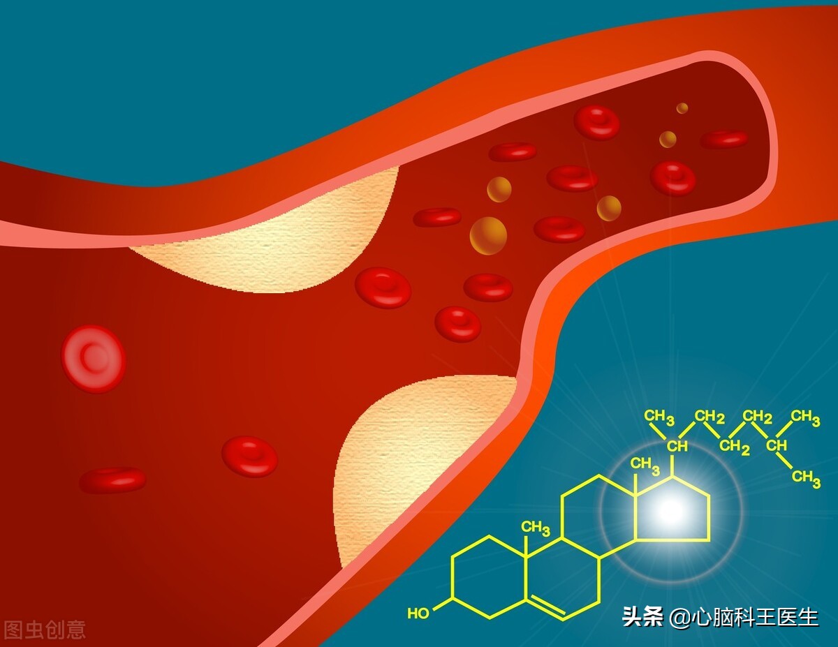 脑梗死偏瘫患者肢体康复方法,脑梗偏瘫怎样恢复最快四肢无力