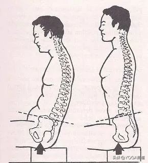 瑜伽骨盆前倾的最有效的矫正方法,练瑜伽侧腰抻着了怎么办