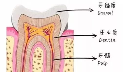 孩子蛀牙要戴牙冠吗,孩子蛀牙也需要根管治疗吗