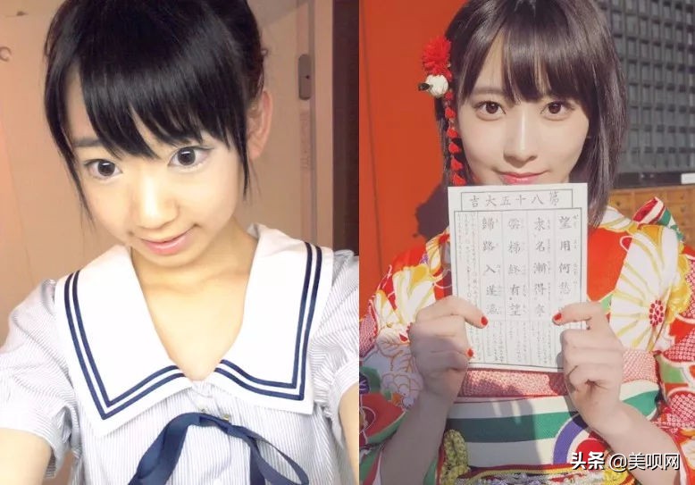 明星都在用的缩小鼻翼神器,明星鼻子做鼻翼缩小外切