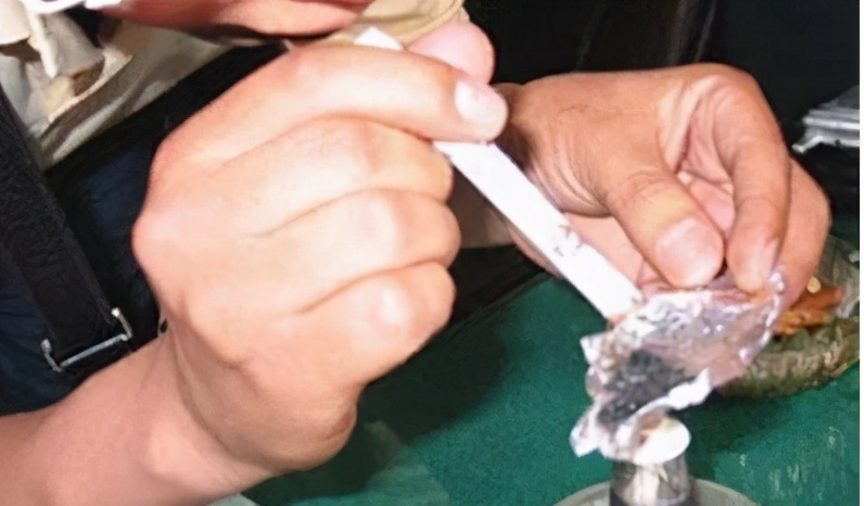 吸毒治疗脑梗的案例,吸毒引发脑梗