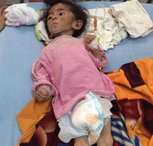 24岁网红收养皮包骨弃婴,还记得那个被抛弃的女孩吗