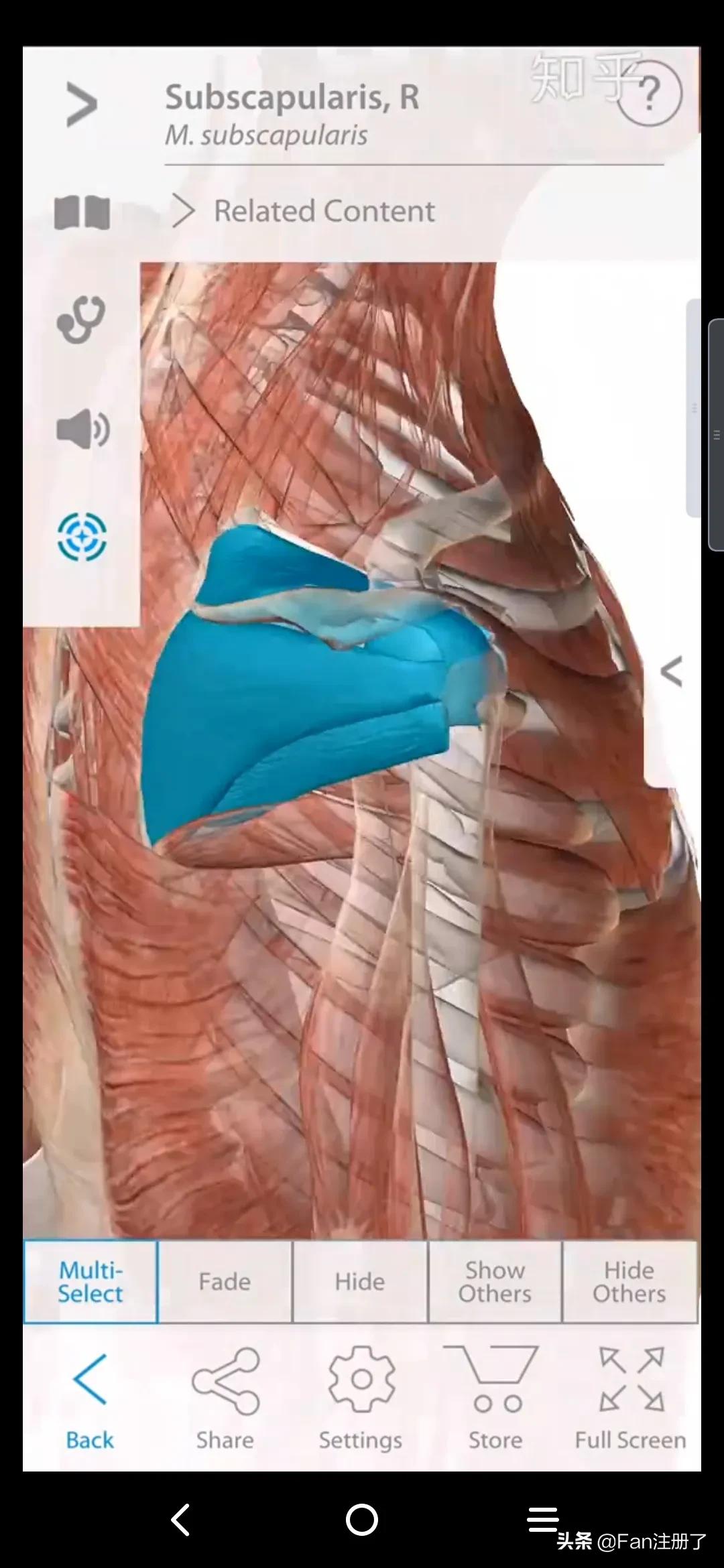 肩痛肩袖损伤针刀治疗,肩痛肩关节活动受限用什么药