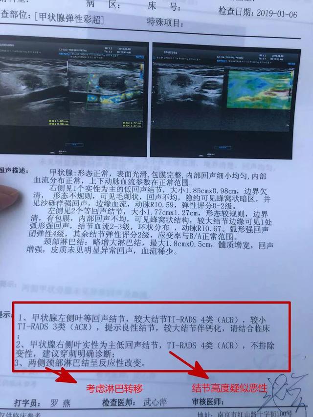 手术又如何，这是上天送给我的一条定制款“微笑项链”