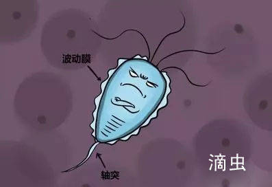 阴道炎症状检测,阴道炎症状怎么检查