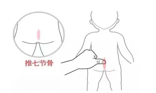 小儿腹泻补液疗法,小儿腹泻无尿怎么补液