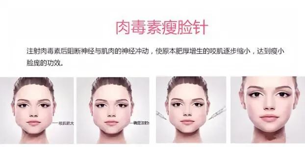 打了瘦脸针运动会瘦吗,瘦脸针要打多久才会瘦