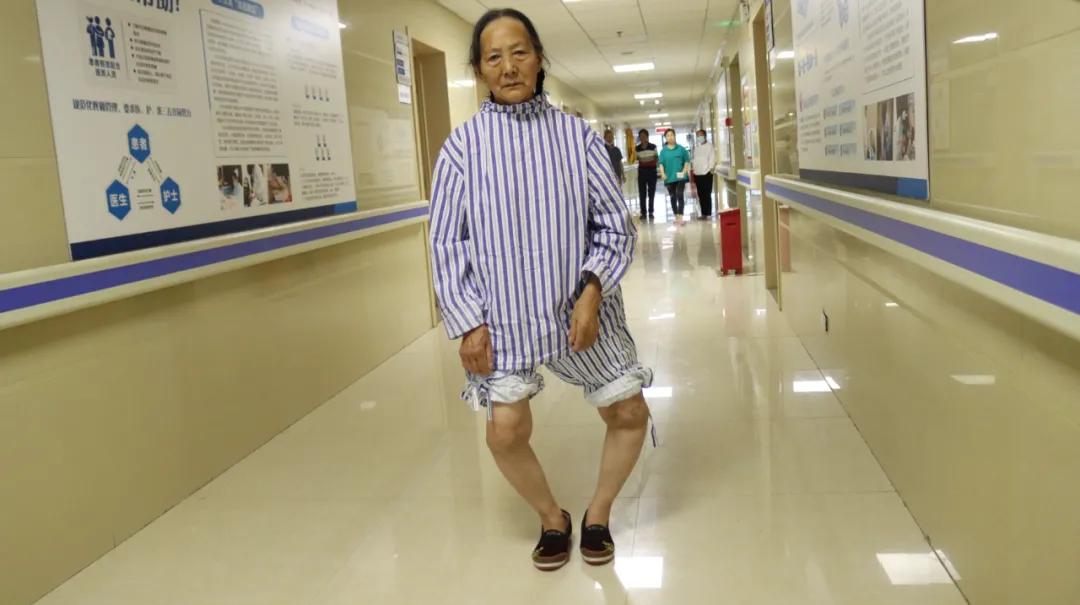 73岁的老人腿弯曲变形怎么办,老人腿疼变形成罗圈腿怎么办