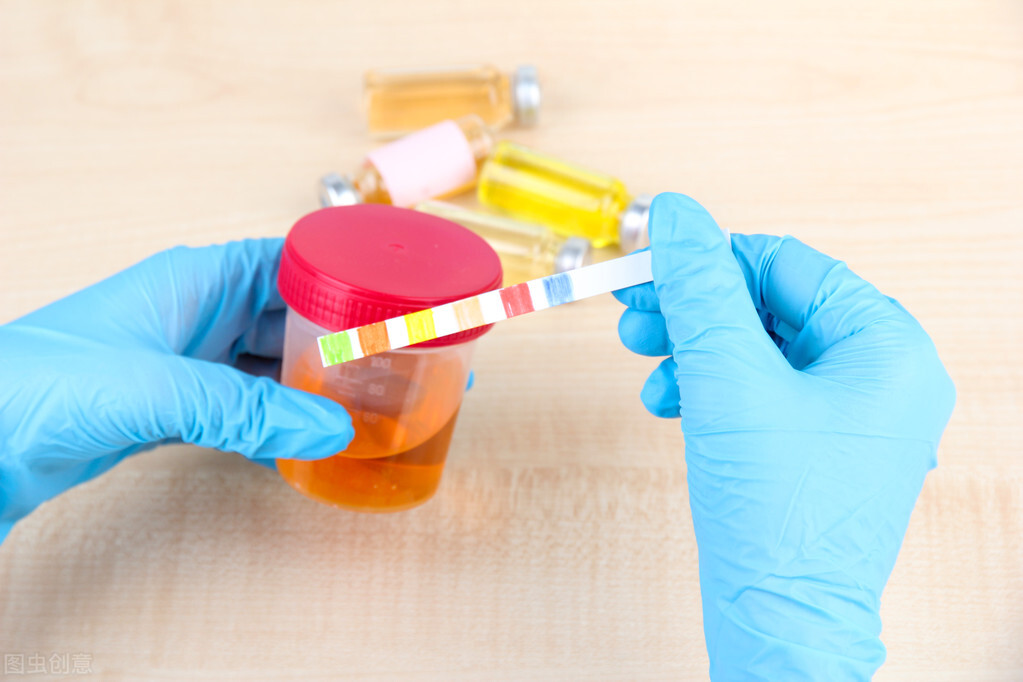 尿蛋白2+尿潜血3+怎么回事严重吗,单纯尿潜血3+尿蛋白2+肾功能正常