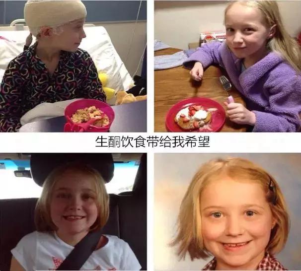 癫痫患儿救命药,婴儿癫痫痉挛性发作的激素疗法