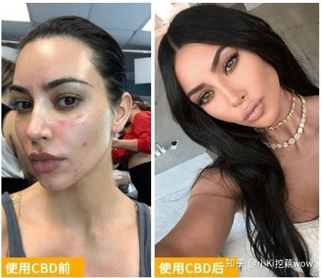 哪些产品有cbd成分,cbd是什么成分