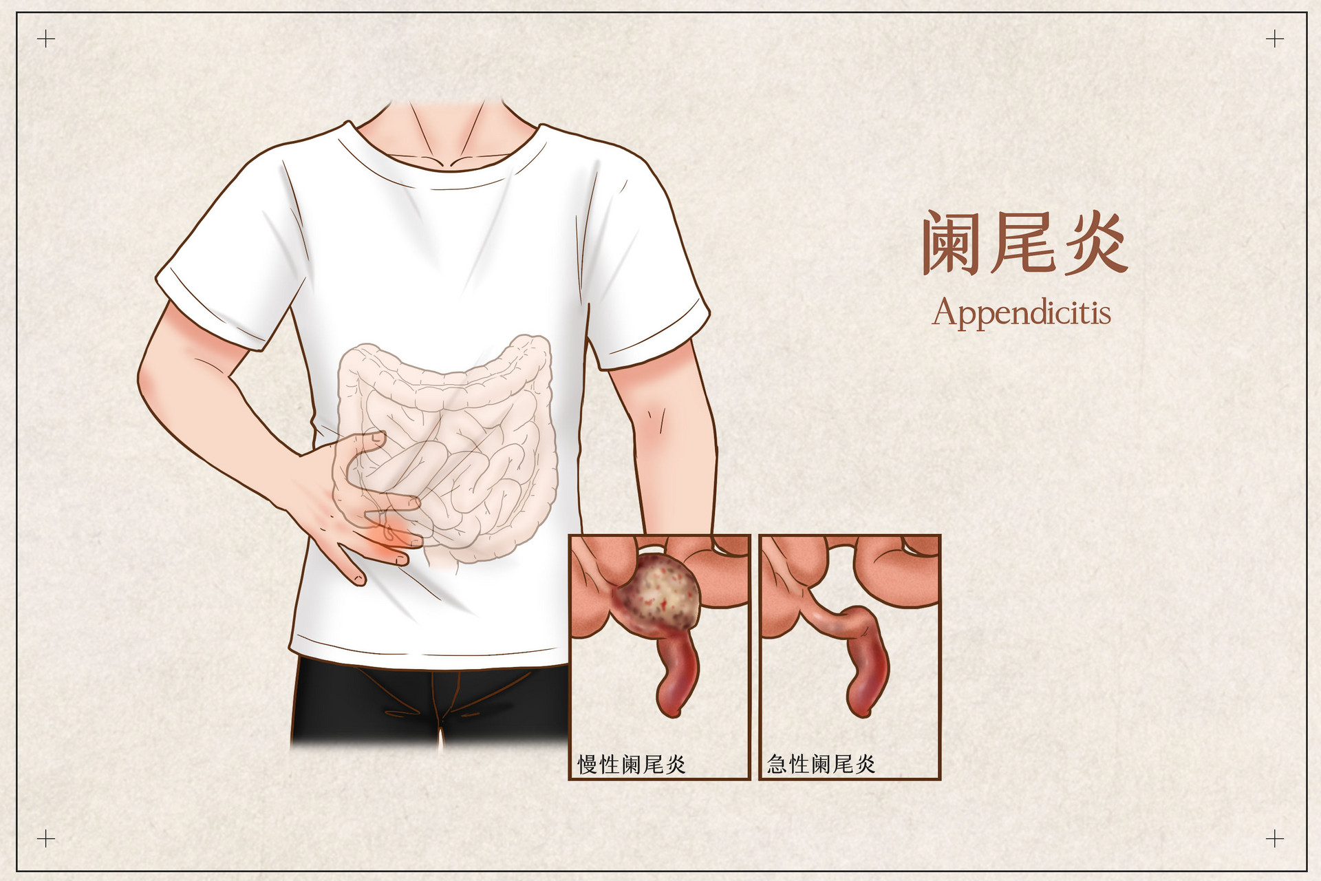 化疗后患者身体差,化疗身体扛不住还有继续的必要吗