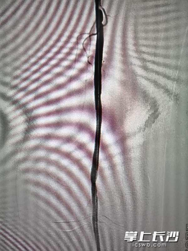 84岁爹爹为什么脚肿,60岁爹爹脚踝肿是怎么回事