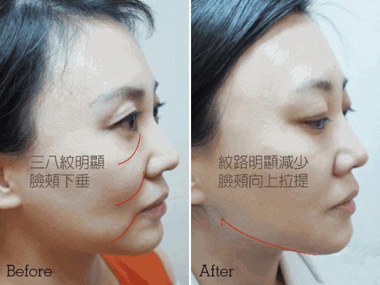 美白祛黄提亮肤色泡水喝,每天喝一杯可以美白淡斑清热解毒