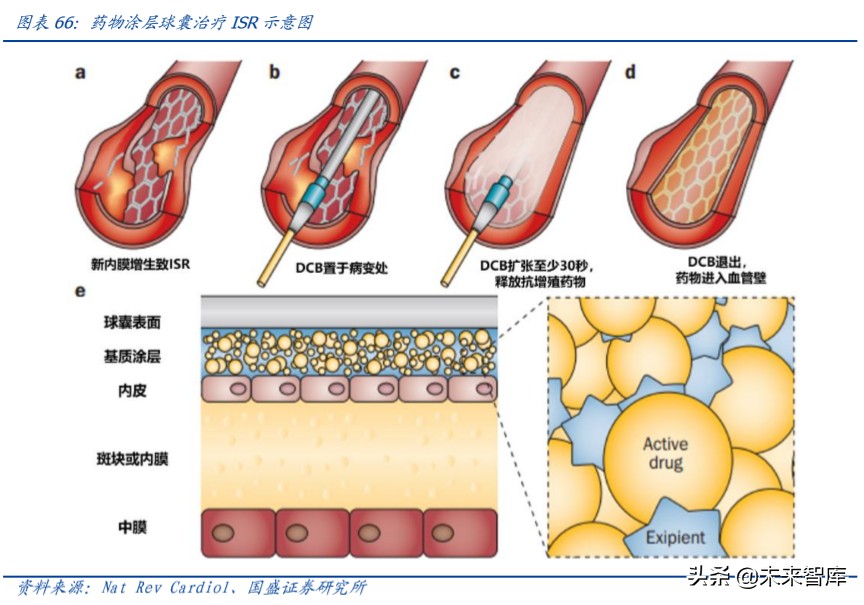 乐普医疗心血管专科医院,乐普医疗的战略