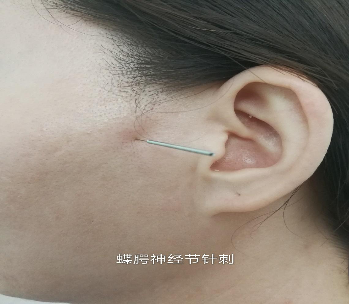 春暖花开鼻子痒不如试试这4招,一到换季鼻子里痒痒怎么治疗