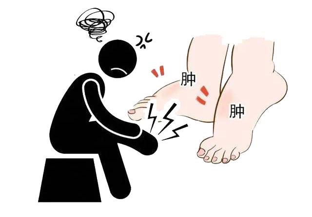 肾水肿最快消肿的方法,肾不好引起的腿部水肿如何消肿