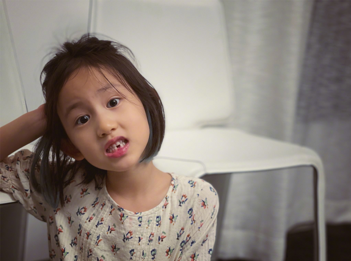 6岁小朋友换牙门牙太大,换牙小知识大全