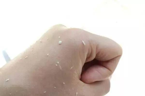 多贵的护肤品都会“搓泥”？这才是搓泥的真正原因，四种方法改善