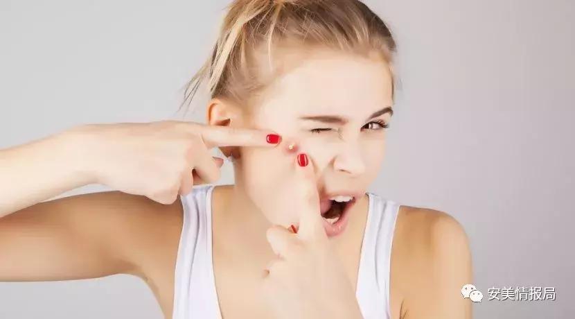 长痘了用什么挤痘痘,痘痘白色的东西挤还是不挤