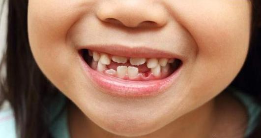 孩子换牙掉的牙怎么处理,孩子换牙掉了怎么处理最好