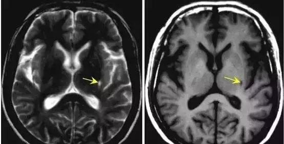拍了片子拿到结果看不明白？彩虹医生教您看懂影像报告