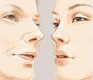 眼睛周围有细小皱纹怎么办,眼睛周围松弛有皱纹怎么修复