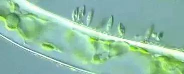 水产养殖藻类老化是怎样的,水产养殖显微镜下各种藻类