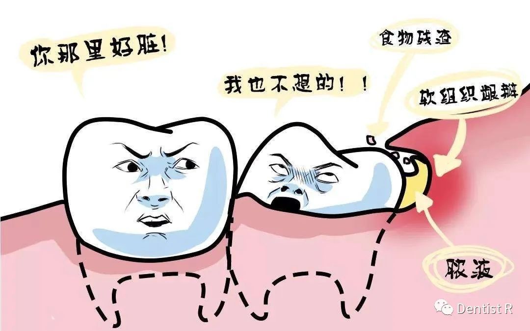 拔智齿能治脸歪吗,科普拔了智齿真的可以瘦脸吗