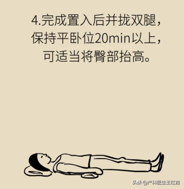 白带增多、脓性灰黄色伴豆渣样、霉菌性阴道炎真的是“发霉”了吗