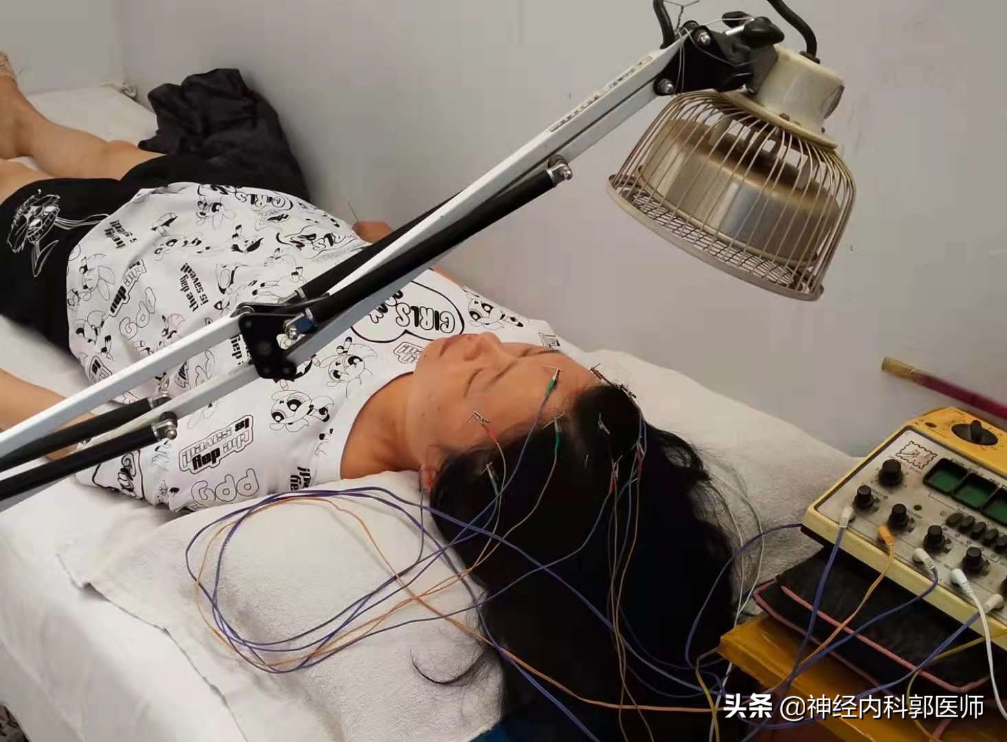 神经性头痛针灸扎什么部位,针灸对神经性头痛有效吗