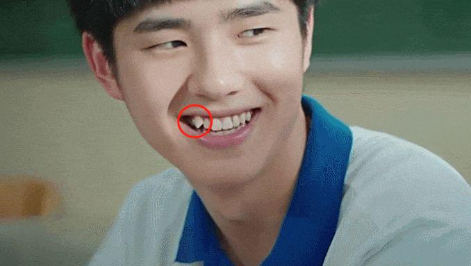 小孩长了虎齿怎么办,小孩长老虎的牙可以矫正吗