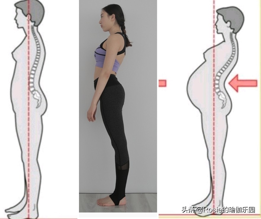 你以为你是翘臀其实是骨盆前倾,你以为的翘臀有可能是骨盆前倾