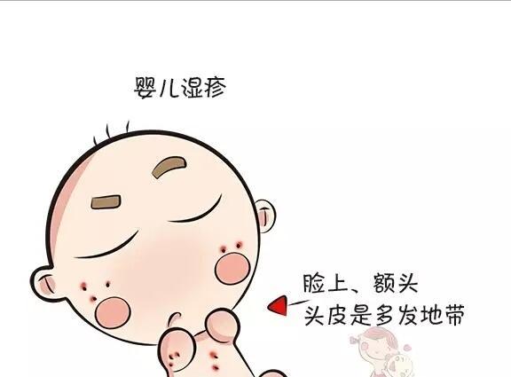 小孩身上起湿疹能用艾叶水洗么,孩子脸上起湿疹可以沾水吗