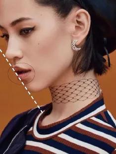 凸嘴怎么自己改善视频,纠正凸嘴后的对比照片