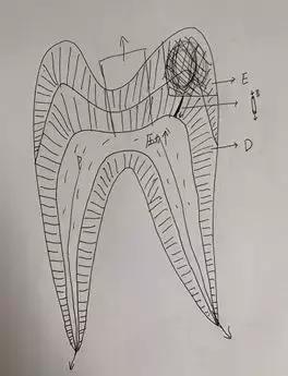 要人命的牙痛该怎么治？搞清这几点，快速解决牙痛烦恼