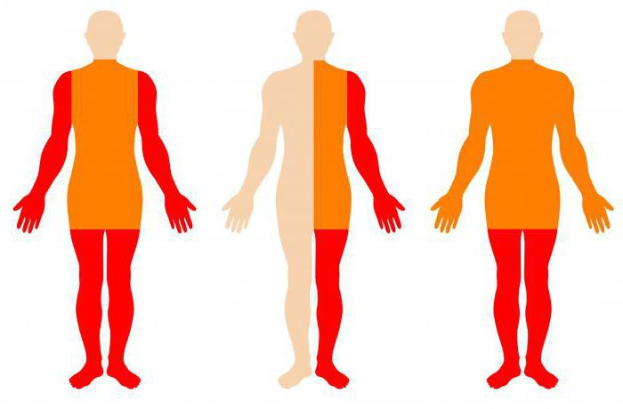 截瘫居家护理,截瘫患者照顾