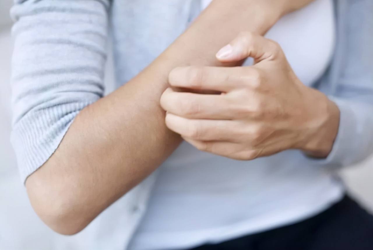 皮肤瘙痒需警惕当心血糖已升高,身上若2处发痒体内血糖已超标