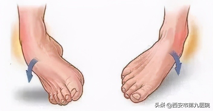 崴脚处理办法,崴脚怎么处理用什么药