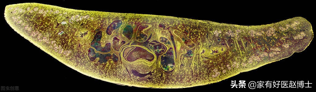细菌、病毒、寄生虫也可致癌?防癌,务必远离7大常见致癌病原体
